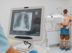 U Srbiji svake godine od raka pluća oboli oko 7.000 ljudi uprkos organizovanom skriningu